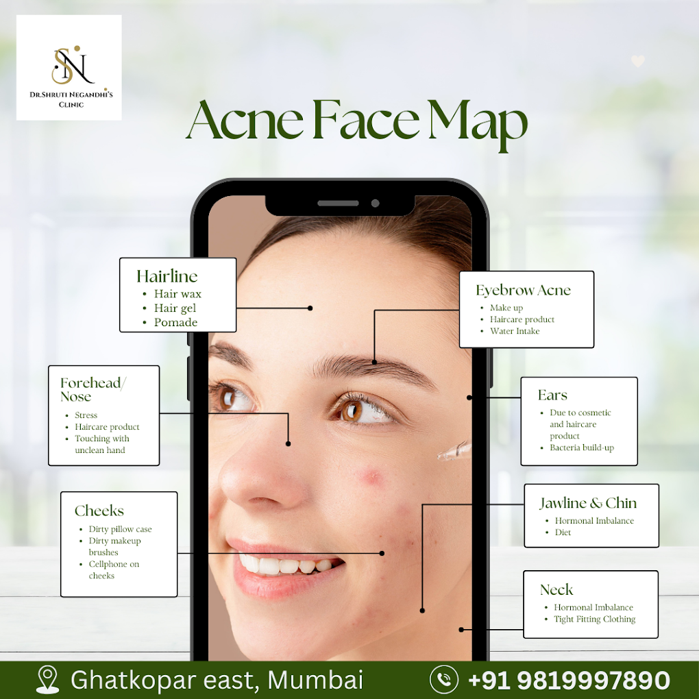 Dermatologist consultation at TressDerma